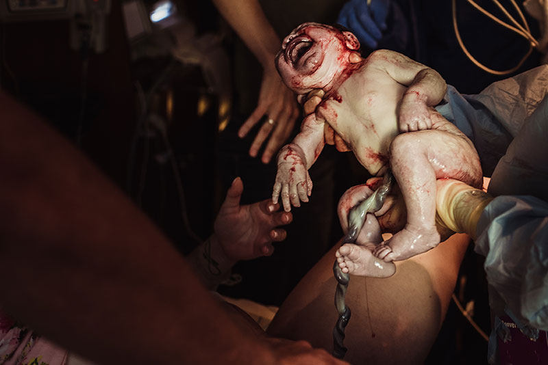 Newborn baby being handed to mother after hospital birth photography