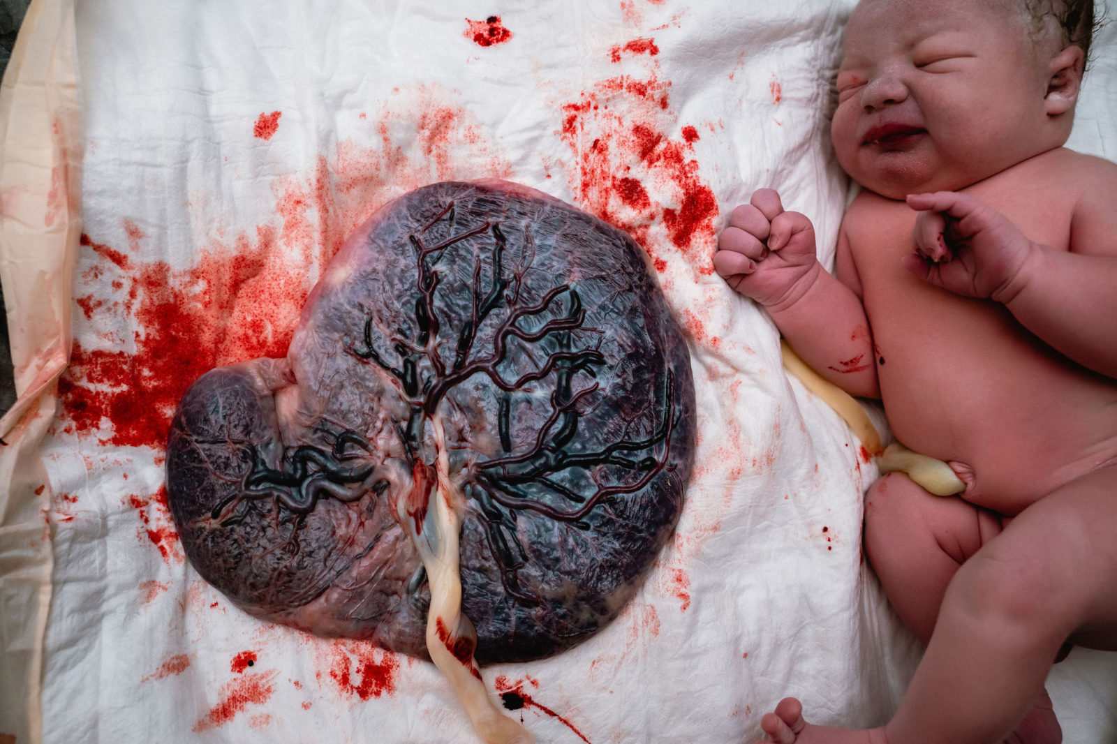 newborn baby and placenta
