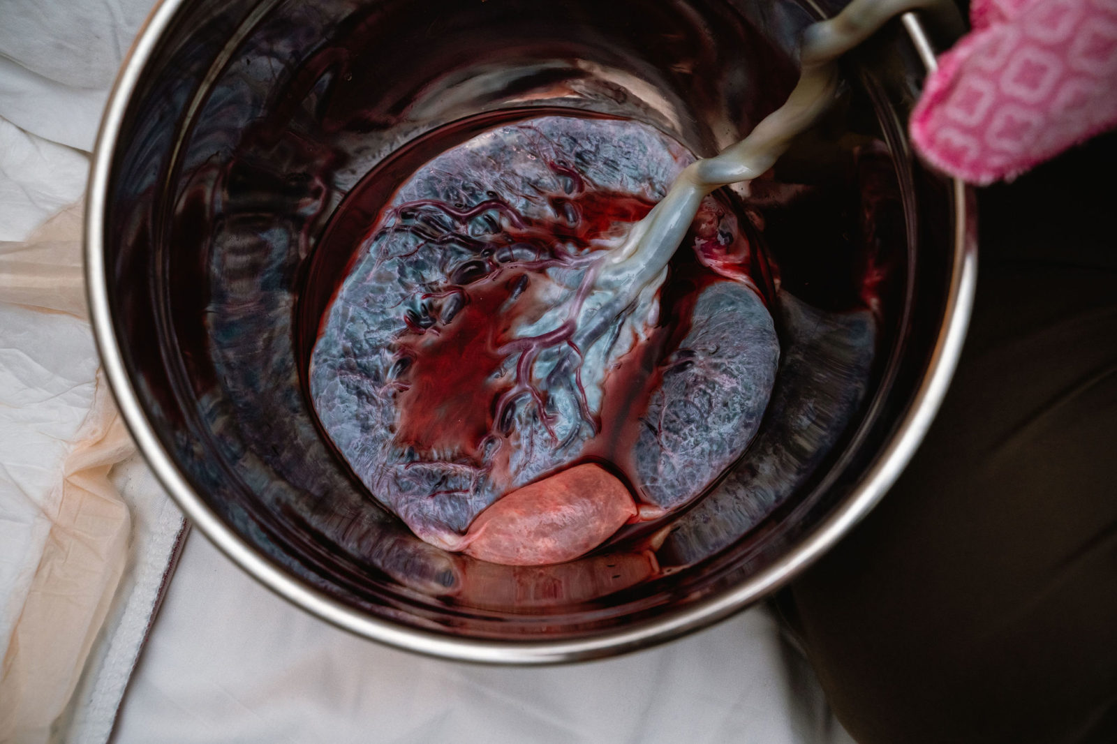 placenta in a bowl
